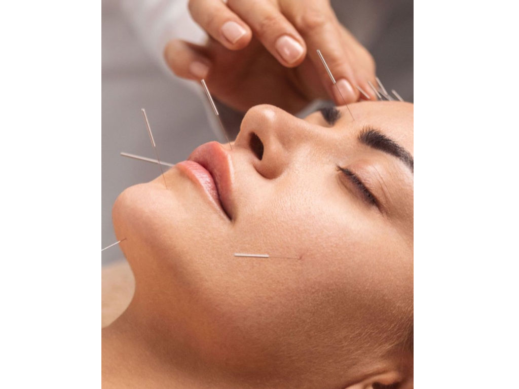 servicios en tratamientos de acupuntura estetica colageno piel