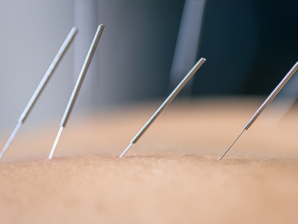 servicios en tratamientos de acupuntura